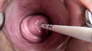 Uterus have fun with Chinese sounding injection